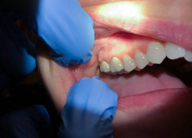 Best Emergency Tooth Extraction  in Genoa, OH